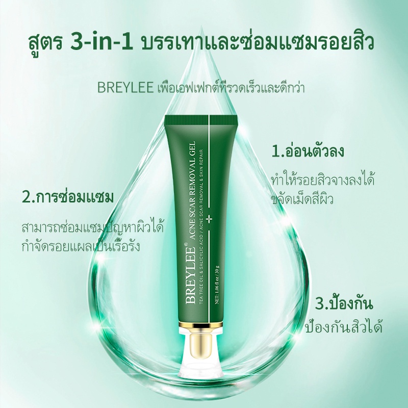 คูปองใหญ่-breylee-เจลแต้มสิว-ลบรอยสิว-เจล-fda-ยาลดสิว-ลดรอยสิว-ครีมลดสิว-ครีมลดรอยสิว-ครีมลบรอยสิว-remove-acne-scars