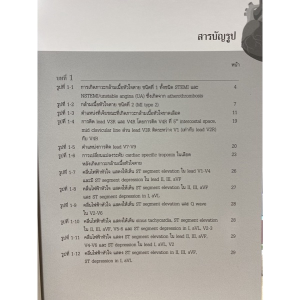 9786165771962-c111-ภาวะกล้ามเนื้อหัวใจขาดเลือดเฉียบพลัน-ชนิด-stemi-acute-st-segment-elevation-myocardial-infarction