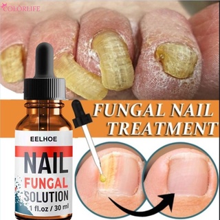 【New】 10/20/30ml foot anti-fungal essence to remove onychomycosis repair treatment liquid healthy nail care repair liquid 【Col】