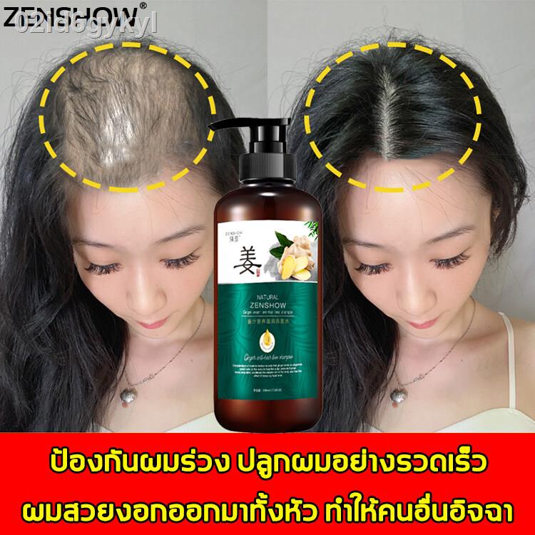 zenshow-แชมพูขิงเพียว-แชมพูแก้ผมร่วง-ผมร่วง-รักษาผม-รักษาผมร่วง-ป้องกันผมร่วง-เคราตินบำรุงผม-ผมร่วงผมบาง-หงอก-ปลูกผมเร่ง