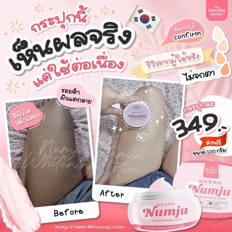 นัมจู-numju-vitamin-whitening-lotion-วิตามิน-ไวเทนนิ่ง-โลชั่นวิตามินเกาหลี-ครีมทารักแร้-ก้น-ขาหนีบ-ข้อศอกหัวเข่า-ให้ขาว