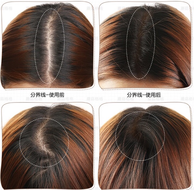 suake-hair-shadow-ที่ปิดเหม่ง-ที่ปิดหัวเหม่ง-ปิดผมบาง-ปิดเหม่งพร้อมโชว์-ให้ผมคุณดูหนาขึ้น