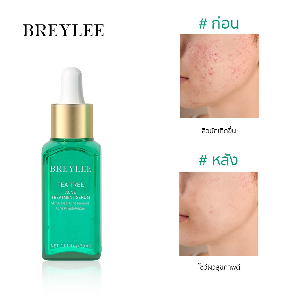 ซื้อ-1-แถม-1-cod-breylee-เซรั่มทรีทเม้นท์รักษาสิวทีทรี-กำจัดสิว-หน้าใส-เซรั่ม-30มล-acne-treatment-skin-care-serum