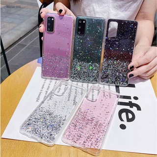 Realme C35 C25 C21 C20 C20A C21Y C20A C25S C25Y เคสเรียวมี สำหรับ Case Silver Foil เคส เคสโทรศัพท์ เคสมือถือ เคสนิ่ม เคสซิลิโคน