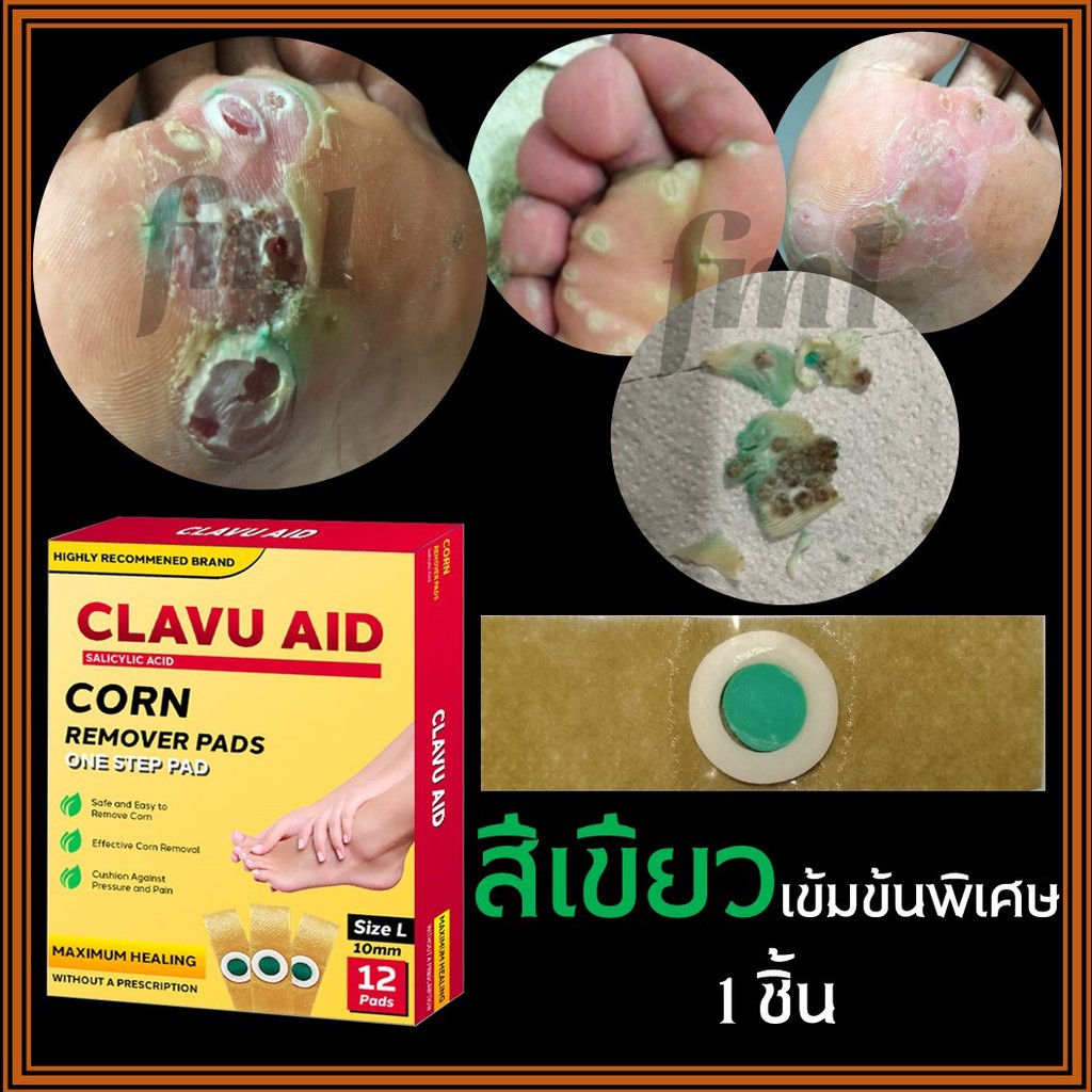 ภาพหน้าปกสินค้าClavu Aidแผ่นแปะกำจัดหูด ตาปลา สูตรเข้มข้น จากร้าน fml_bkk บน Shopee
