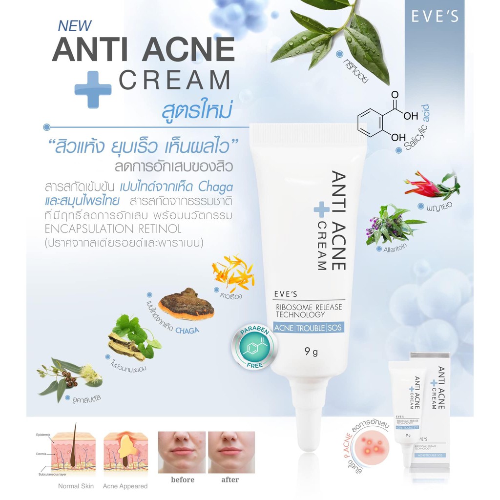 ครีม-แต้ม-สิว-อีฟส์-eves-anti-acne-cream-ขนาด-9-กรัม