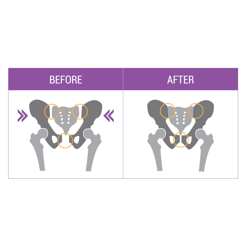 hip-fitt-เข็มขัดกระชับสะโพก