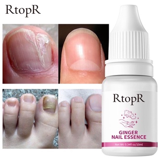 ส่งจากไทย!! RtopR FDA ยาทาเล็บป้องกันเชื้อแบคทีเรีย รักษาโรคเชื้อราที่เล็บ เล็บพัง ดูแลเล็บ 10 มล.