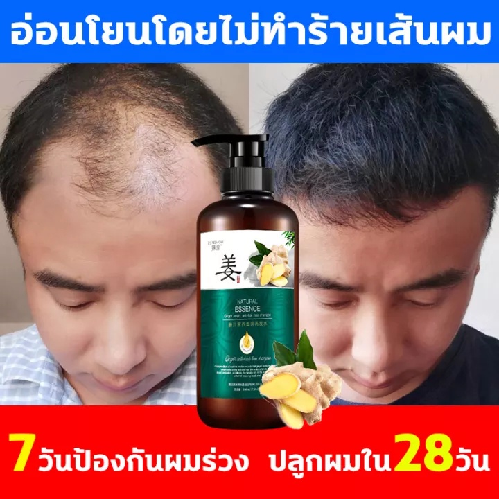 zenshow-แชมพูขิง500ml-แชมพูแก้ผมร่วงบำรุงผมร่วงรักษาผมร่วงป้องกันผมร่วงเคราตินบำรุงผมผมร่วงผมบางหงอกปลูกผมเร่งด่วน-1591