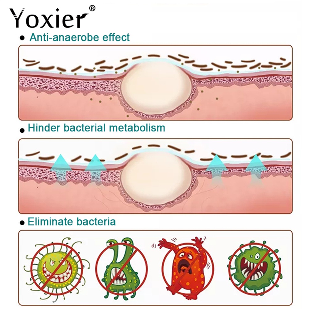 ใหม่-yoxier-ครีมสมุนไพร-บรรเทาอาการคัน-โรคสะเก็ดเงิน-โรคเรื้อรัง-ผื่นกลาก-20-กรัม