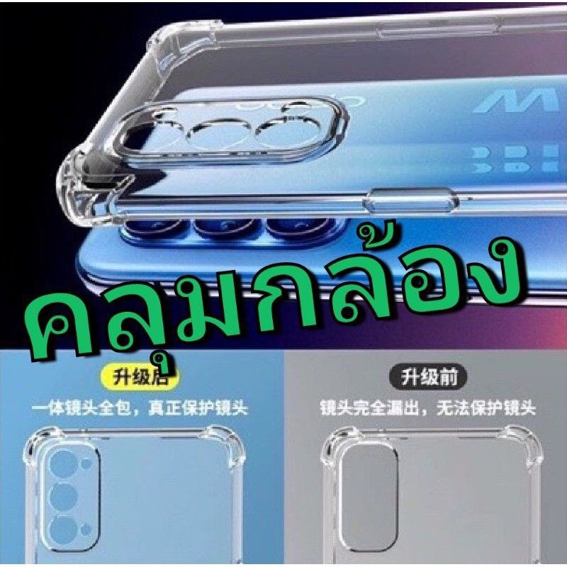 ภาพสินค้า(พร้อม​ส่งในไทย)เคสใสกันกระแทกแบบคลุมกล้องXiaomi Poco F3/Poco M3/Redmi K40/K40Pro จากร้าน adphone บน Shopee ภาพที่ 1