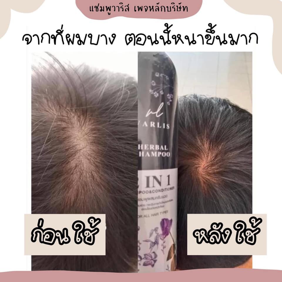 แชมพูวาริส-2in-1-varlis-shampoo-baimee-and-butterfly-shampoo-400-ml