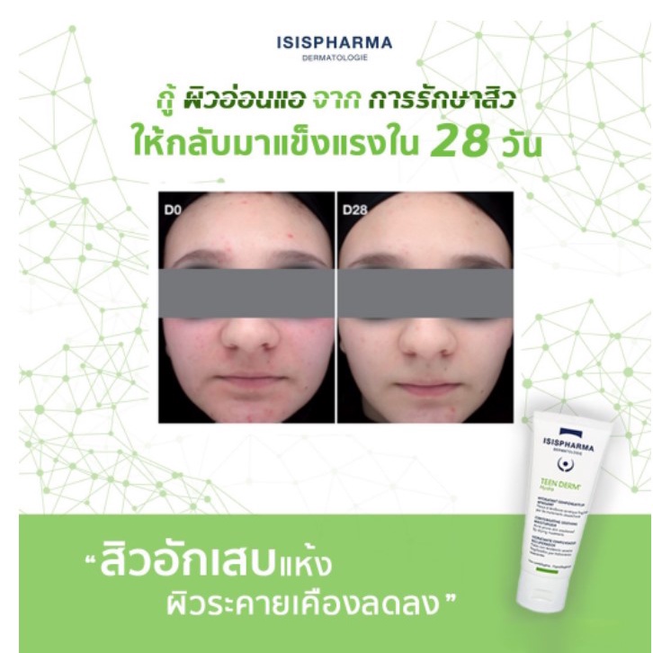 isispharma-teen-derm-k-k-concentrate-alpha-pure-hydra-isis-pharma-teenderm-ลดสิว-เวชสำอางค์-คุมมัน-รักษาสิว