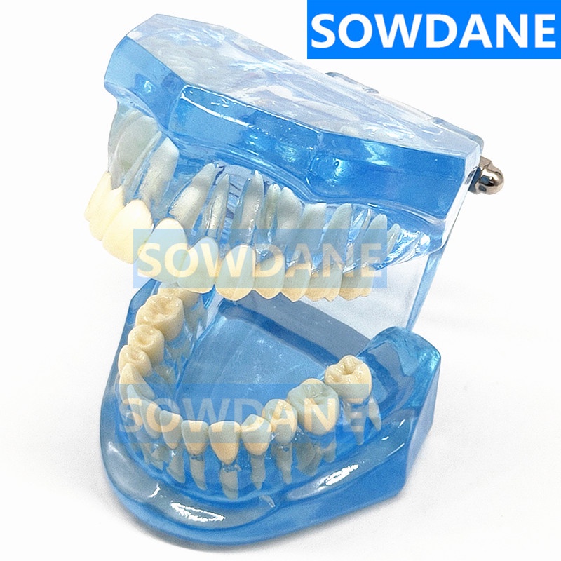 1pc-dental-standard-tooth-model-orthodontic-model-for-patient-communication-dental-study-clinic-model-tool