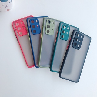 เคสมือถือXiaomi Redmi NOTE11 Poco F3 M3 Mi11 Mi 11 Lite Redmi Note 10 เคสโทรศัพท์ ขอบสีกันกล้อง เคสกันกระแทก ส่งจากไทย