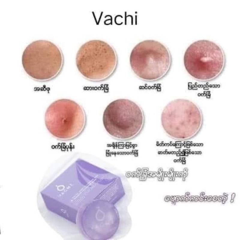 vachi-สบู่ล้างหน้าขจัดสิวผิวเด้งฟรีฟองน้ำขัดผิวในกล่อง