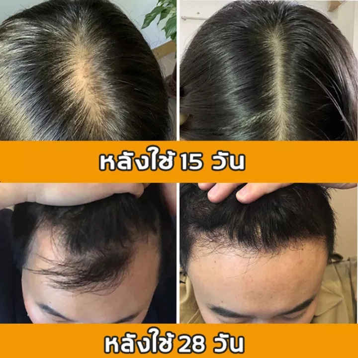 originalแชมพู-เร่งผมยาว-แชมพูเร่งผมยาว-เส้นผมแข็งแรง-250ml-แชมพูป้องกันผมร่วง