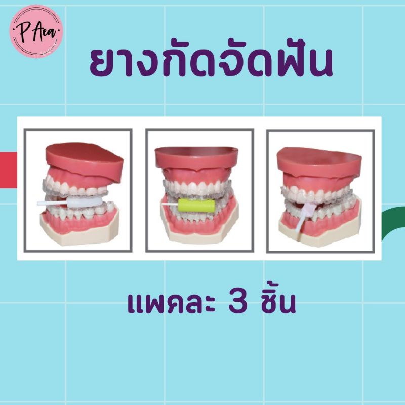 ยางกัดจัดฟัน-แพ็ค-3-ชิ้น-กลิ่นหอม-ยางกัดสำหรับคนจัดฟันแบบใส-chewie-aligner