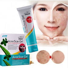 acne-scar-gel-ให้ความชุ่มชื่นสดใสซ่อมแซม-ในรายการรวมด้วย-1-x-ว่านหางจระเข้แผลเป็นจากสิว
