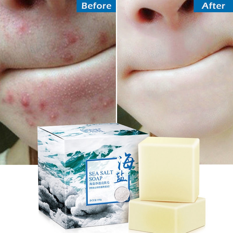 sea-salt-soap-cleansing-soap-eliminate-acne-pores-acne-goat-milk