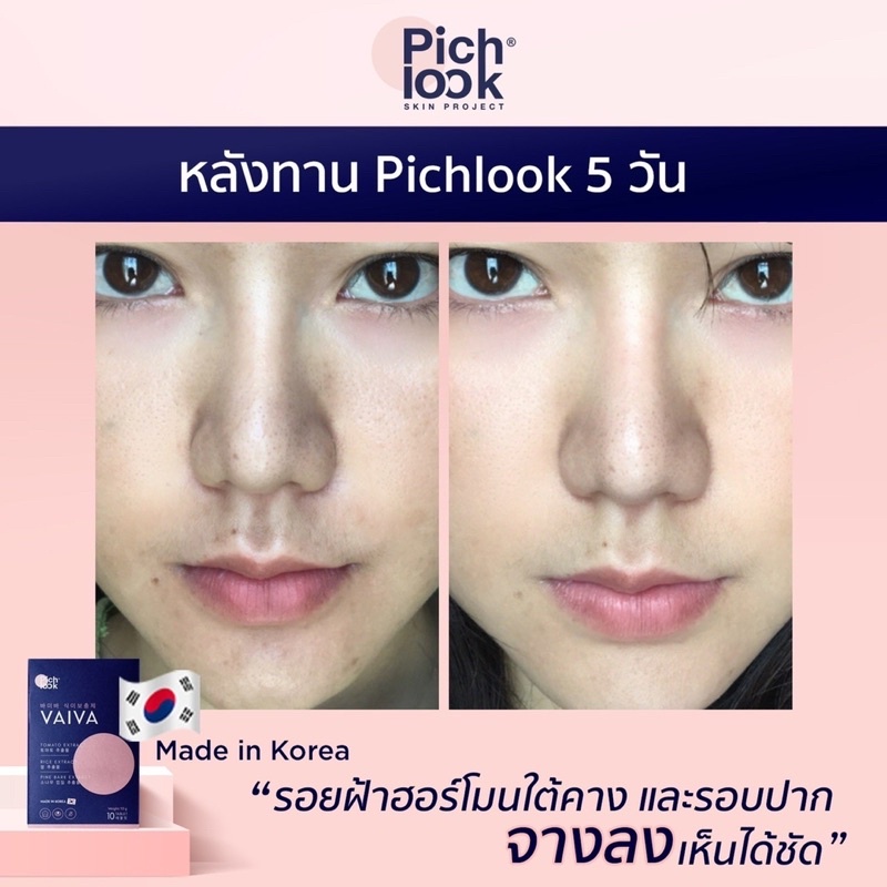 vaiva-by-pichlook-ผิวขาวใสออร่า