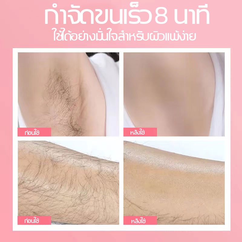 มูสกำจัดขนถาวร-miziy-ครีมกำจัดขน-กำจัดขนน้องสาว-มูสกำจัดขน-กำจัดขนขา-กำจัดขนรักแร้-hair-removal-spray-กำจัดขนไม่เจ็บปวด