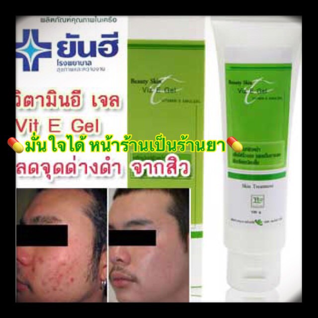 yanhee-viz-e-gel-100g-ยันฮีวิตามินอีเจล