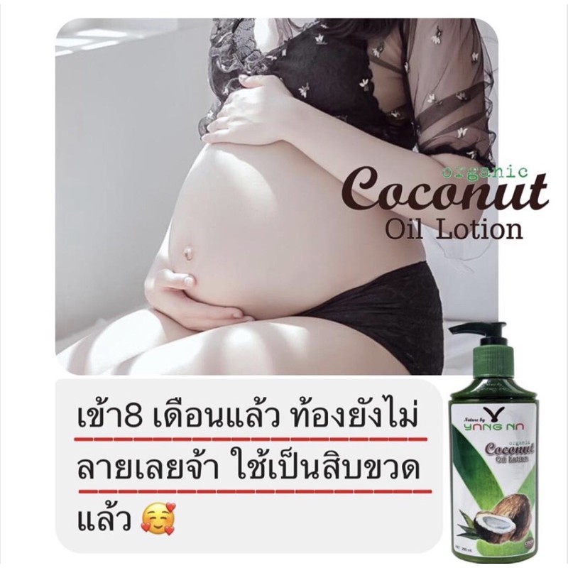 ครีมทาท้อง-ครีมทาท้องแตกลาย-โลชั่นมะพร้าว-โลชั่นสำหรับคนท้อง