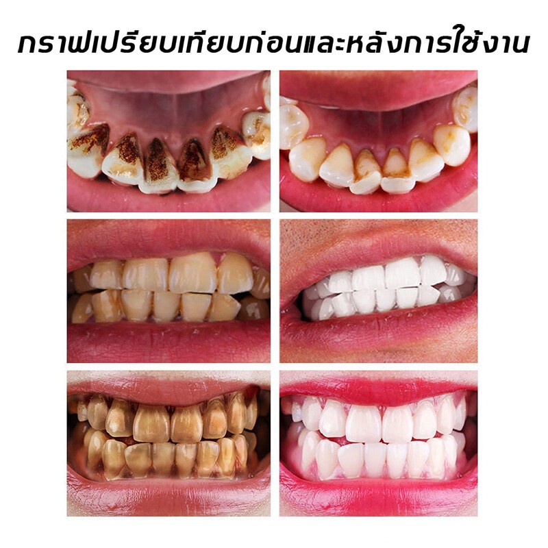 peimei-ยาสีฟันฟันขาว-100g-ยาสีฟันสุภาพร-ยาสีฟันดาลี่-ดูแลฟัน-ยาสีฟันขจัดหินปูน-ฟันเหลือง-ฟลูออไรด์ยาสีฟัน-ปากสะอาด