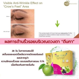 ภาพขนาดย่อของภาพหน้าปกสินค้าume gold plus 20 ซอง สุดคุ้ม ยูมีโกลด์ พลัส ของแท้ จากร้าน umeplusonline บน Shopee ภาพที่ 3