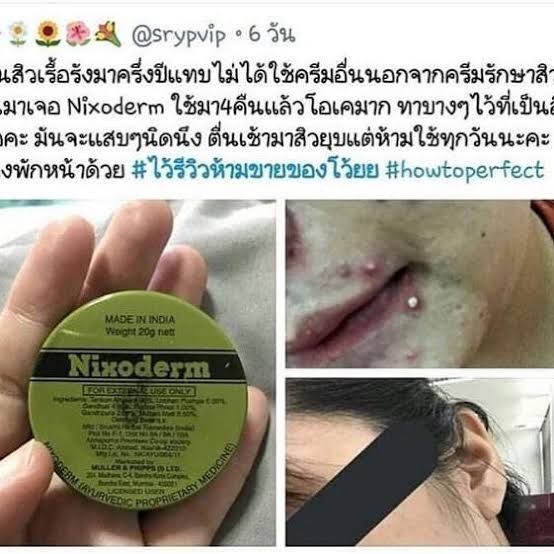 nixoderm-ครีมรักษาสิว-สิว-สิวอักเสบ-สิวอุดตัน-สิวผด-ผื่น-กลากเกลื้อน-อาการคัน-เชื้อรา-บรรเทาอาการคันตามผิวหนัง-ผลิต07-21