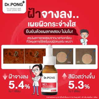 ภาพขนาดย่อของภาพหน้าปกสินค้าDr.PONG MC1 WHITENING DRONE MELAS CLEAR SERUM เซรั่มฝ้ากระ เพื่อผิวหน้ากระจ่างใส Tranexamic acid 3% จากร้าน drpongshop บน Shopee ภาพที่ 7