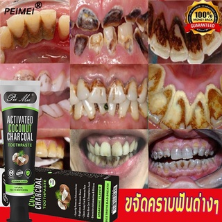 PEIMEIยาสีฟันไวท์เทนนิ่ง 100g ฟันขาวลดคราบพลัค ยาสีฟันฟอกฟันขาว เจลฟอกสีฟัน เอสเซ้นฟอกสีฟัน ฟอกสีฟัน