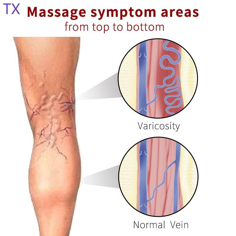 varicose-แผ่นพลาสเตอร์กําจัดเส้นเลือดขาบรรเทาความเมื่อยล้าเส้นเลือดขาใช้งานง่าย