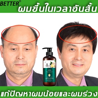 BETTER แซมพูขจัดรังแค แชมพูขิงเพียว 500ml สดชื่นคุมมัน รากผมแข็งแรง แก้ปัญหาผมร่วง แชมพูแก้ผมร่วง ยาสระผมแก้ร่วง