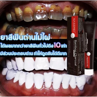 ภาพหน้าปกสินค้าNASSMEI ฟันเหลืองมีกลิ่นปาก? ครบทีม! ยาสีฟันถ่านไม้ไผ่ช่วยคุณได้ แปรงฟันขาว ปากสะอาด（ยาสีฟัน/ฟอกสีฟันขาว/ยาสีฟันสมุนไพร） ที่เกี่ยวข้อง