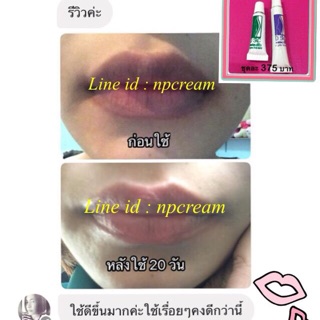 ครีมทาปากดำเดอร์มาคลีนิค