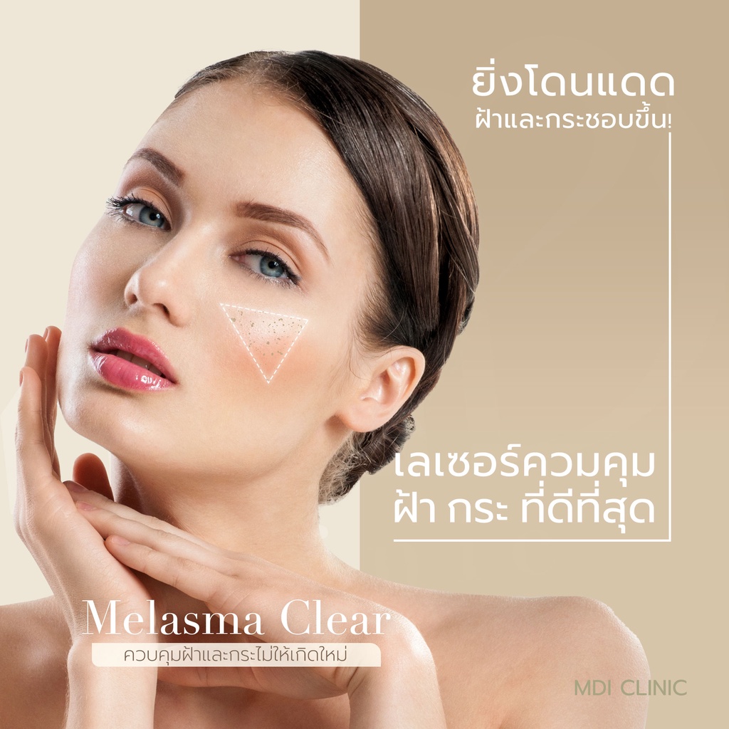 Melasma Clear (เลเซอร์ฝ้า กระ) : 1 Times | Shopee Thailand