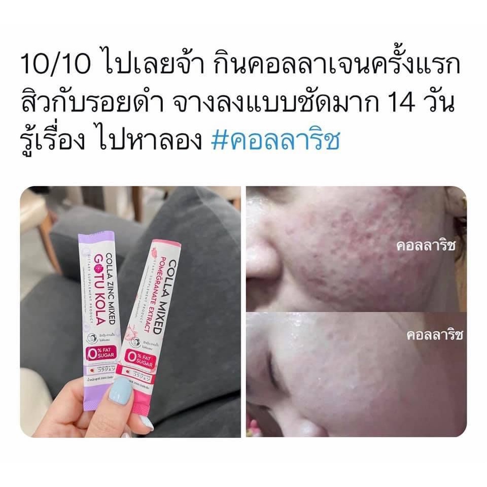 คอลลา-มิกซ์-colla-mixed-amp-colla-zinc-mixed-by-คอลลาริช-colla-rich-คอลลาเจนลดสิว-ขาวไว