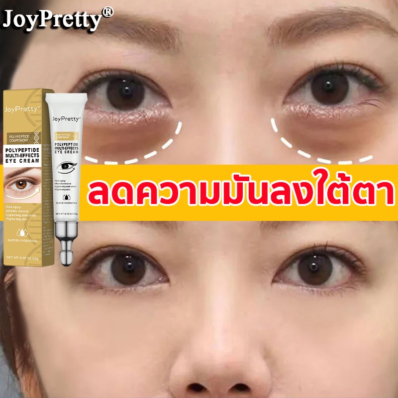 joypretty-ครีมทาใต้ตา-20g-ชุ่มชื้นและชื้นเพื่อลดความจางหายของตาดําถุงตาเม็ดไขมันลายละเอียด-ครีมลดขอบตาดำ-ขอบตาดำ-ครีมทาใต้ตาดำ-ครีมใต้ตา-ครีมลดถุงใต้ตา-ครีมทาขอบตาดำ-อายครีม-ครีมทาถุงใต้ตา-ครีมลดใต้ตา