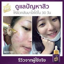 ขมิ้นโกลด์เซรั่ม-เซรั่มจุ๋ย-by-viv-skin-ให้คุณ-มั่นหน้าสด-ด้วยหยดขมิ้นทอง-สน