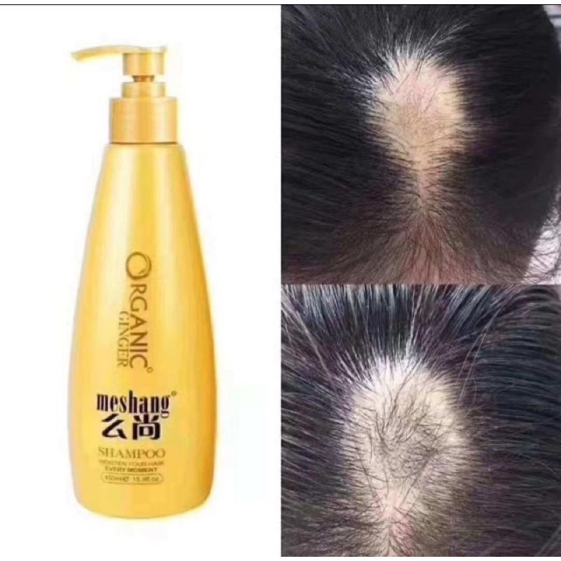 แชมพู-meshang-shampoo-ผลิตจากธรรมชาติ-100