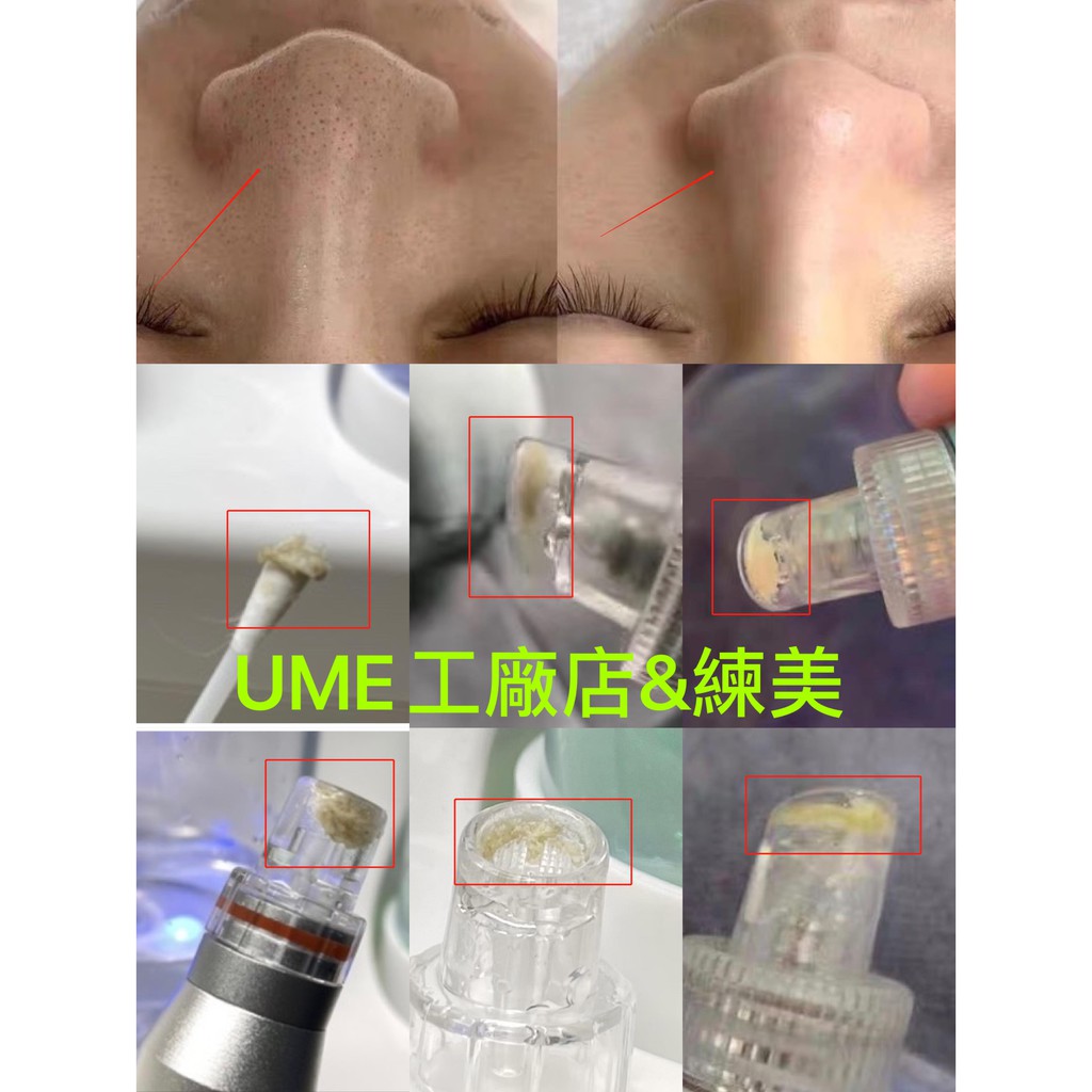 5-11-in-1-bubble-beauty-apparatus-dermabrasion-bio-rf-vacuum-face-cleaning-hydro-water-oxygen-jet-peel-led-machine-wlpl