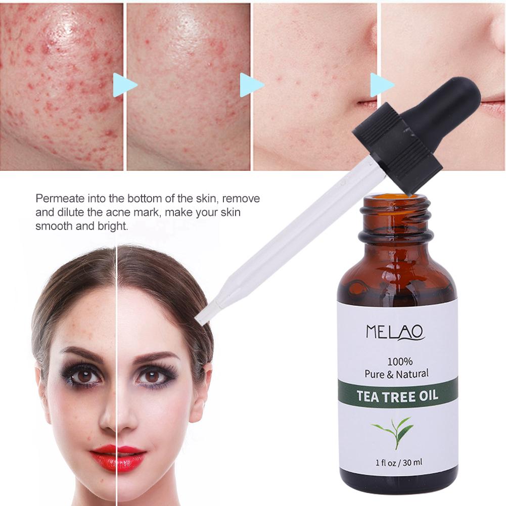 Tea Tree Essential Oil Pores Acne Removal Control Facial Massager Skin Care