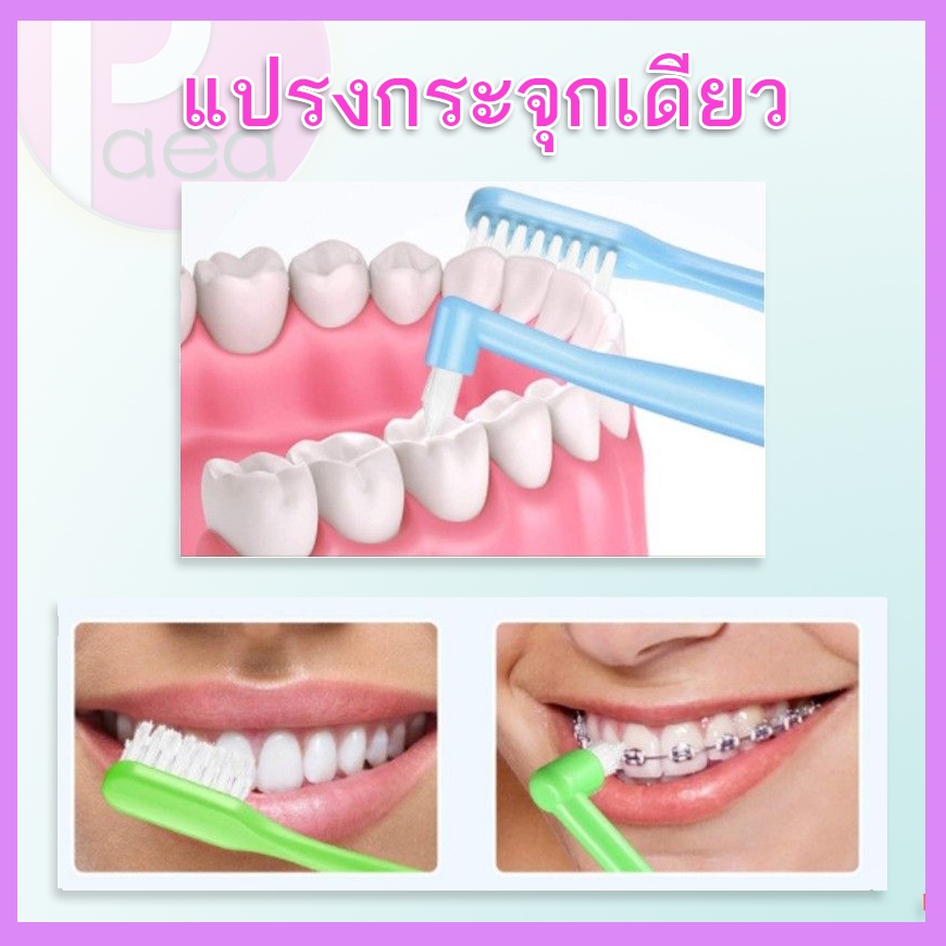 แปรงสีฟันกระจุกเดียว-single-tuft-toothbrush-สำหรับคนจัดฟัน