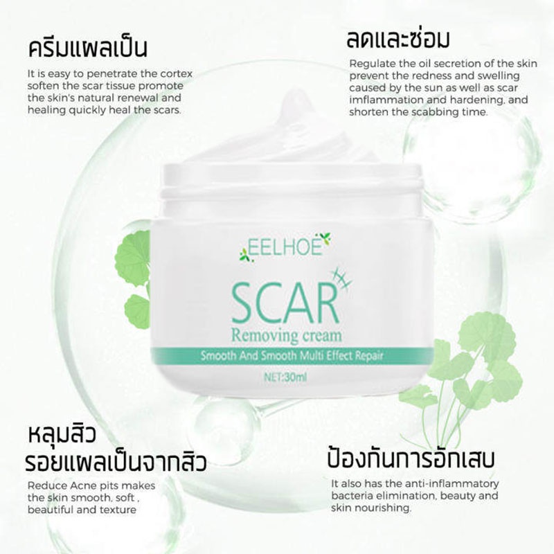 เตรียมจัดส่ง-eelhoe-กรีมรักษารอยแผลเป็น-ครีมลดรอยแผลเป็น-30ml-รอยแผลเป็นจางลงอย่างมีประสิทธิภาพ-ครีมลดแผลเป็น-ครีมทาขาลายจุด-ครีมรักษารอยดำ-ครีมลบแผลเป็น-ครีมรักษาแผลเป็น-ครีมลดรอยแผลไฟไหม้-น้ำร้อนลวก