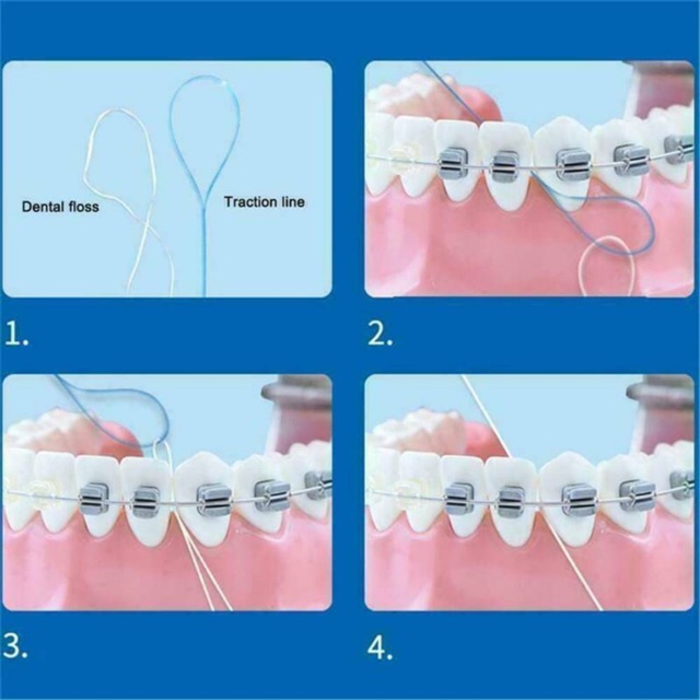 floss-threader-ห่วงร้อยไหมขัดฟัน-ตัวร้อยไหม