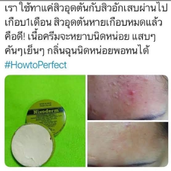 nixoderm-ครีมรักษาสิว-สิว-สิวอักเสบ-สิวอุดตัน-สิวผด-ผื่น-กลากเกลื้อน-อาการคัน-เชื้อรา-บรรเทาอาการคันตามผิวหนัง-ผลิต07-21