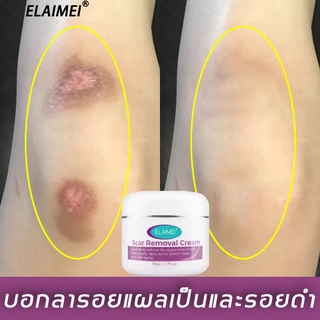 ELAIMEI 50ml ครีมลดรอยแผลเป็น ลบรอยครีมแผลเป็น ครีมรักษาแผลเป็น ยาทาแผลเป็น ลดรอยแผลเป็น