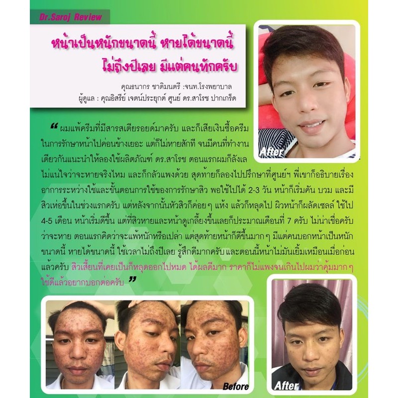 โลชั่นสิว-ดร-สาโรช-เฮอร์เบิล-แอคเน่เคลียร์-โลชั่น-dr-saroj-ครีมทาสิวอุดตัน-สิวอุดตัน-ยาแต้มสิวอักเสบ-ยาทาสิวอุดตัน